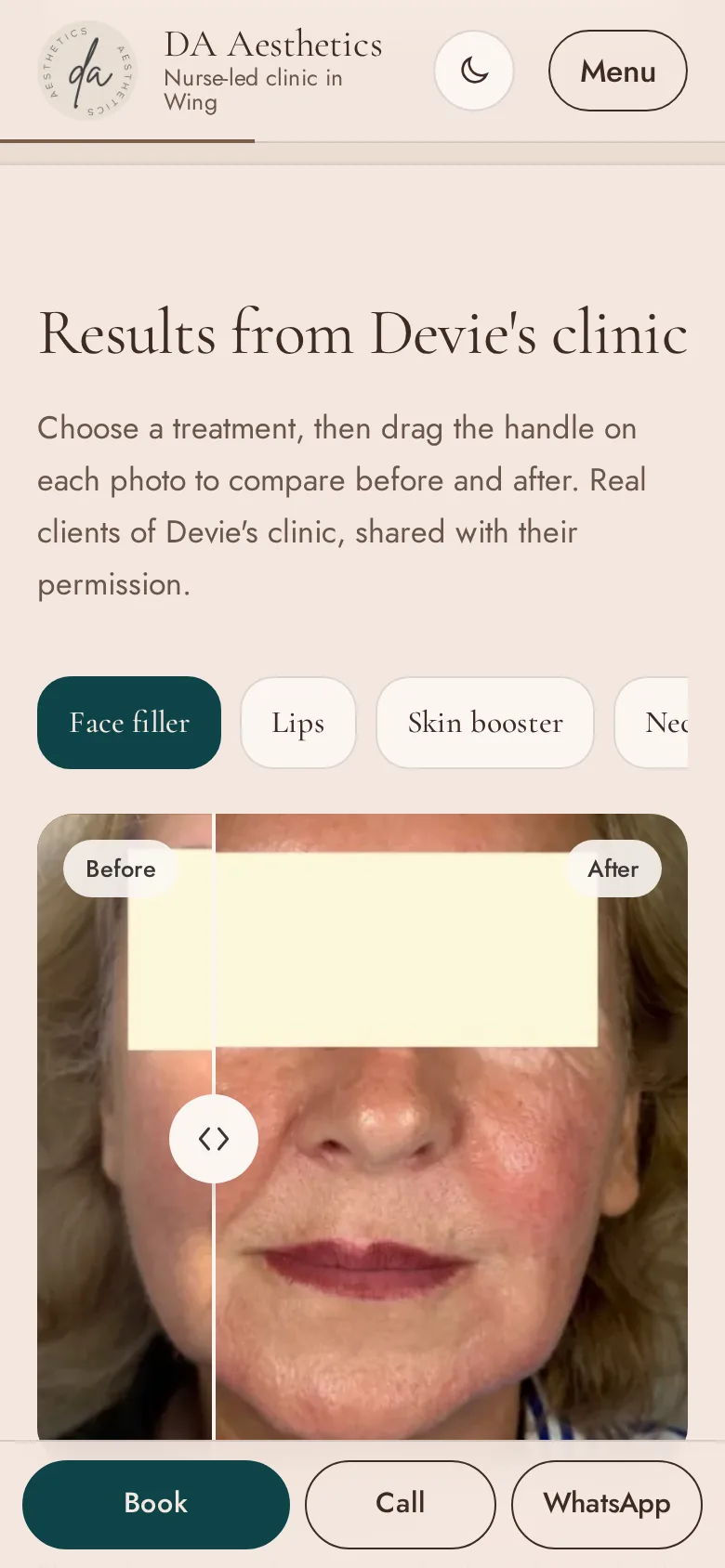 The before and after gallery on the DA Aesthetics website, with faces covered